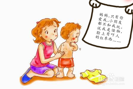 红胎记如何治,红胎记是什么病,父母要知道!