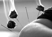 针灸减肥的方法与技巧