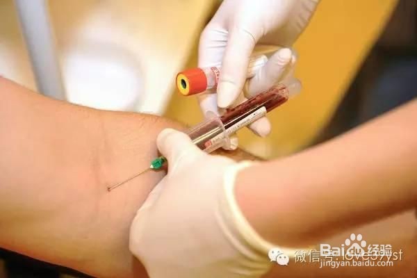 唐筛与糖筛的区别