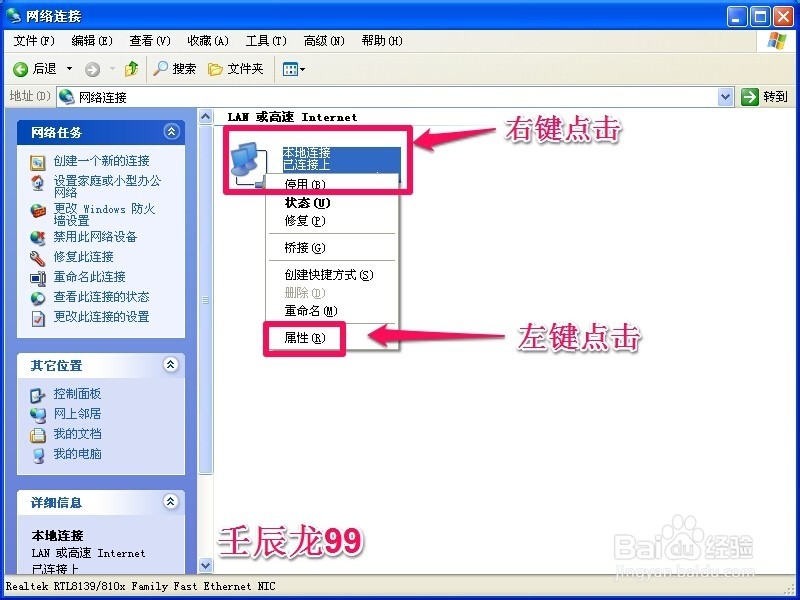 电脑的ip地址怎么修改