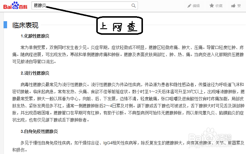 疑患腮腺炎怎么办