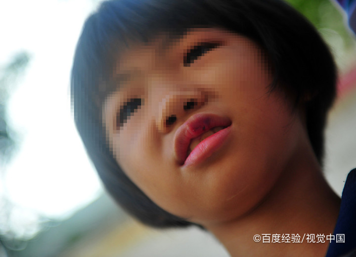 冬天嘴唇干燥起皮有没有什么好办法