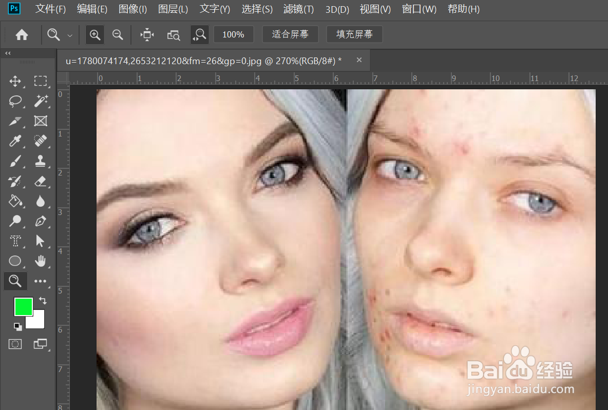 ps如何用污点修复画笔祛痘