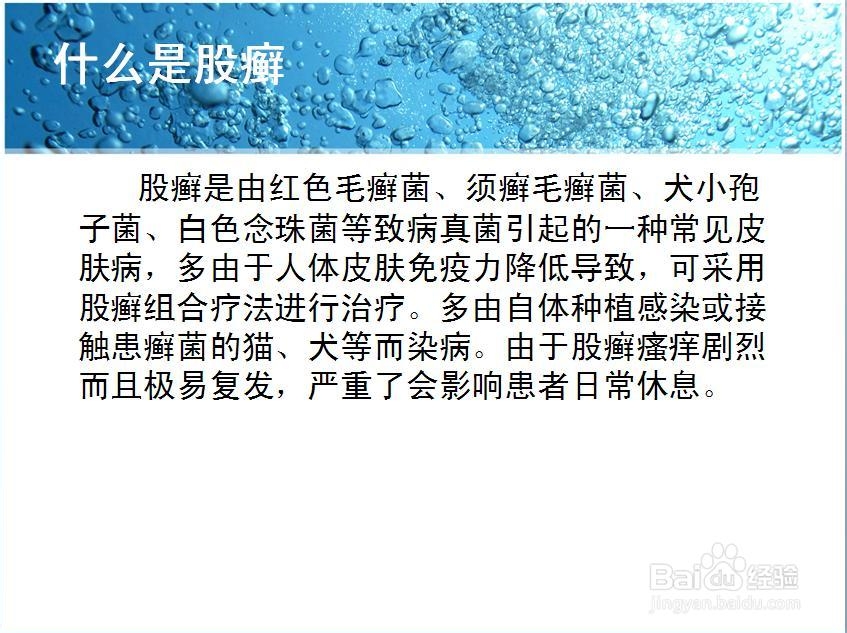 股藓用什么药膏呢