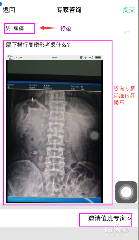 放射沙龙如何进行专家一对一咨询操作