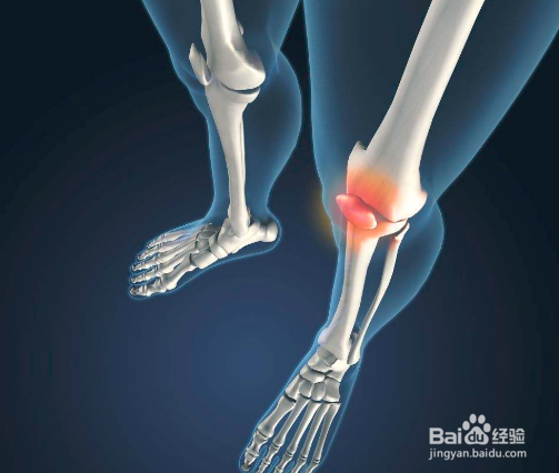 腰肌劳损怎么办？腰肌劳损治疗方法中医更有优势