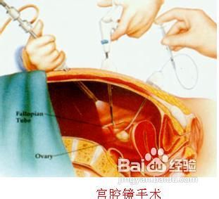 雄性激素分泌旺盛怎么办