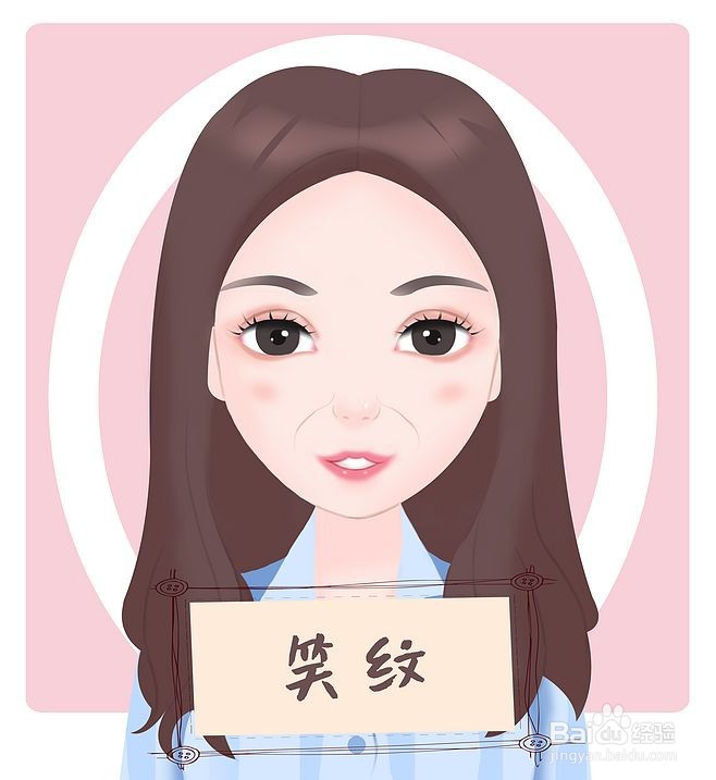 法令纹的类型