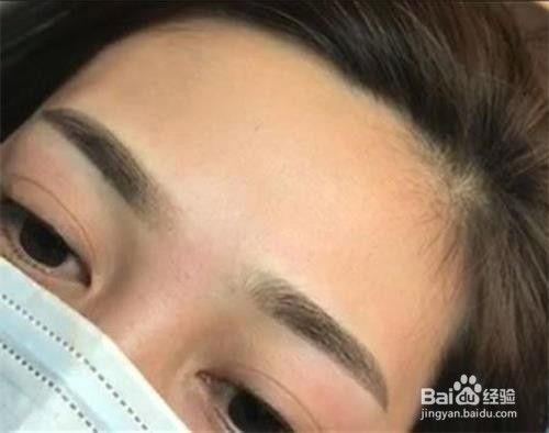眉毛褪色变红怎么办 百度经验