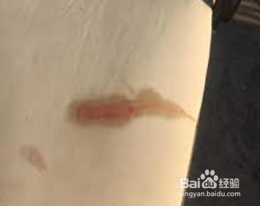 白床单上的血怎么清洗