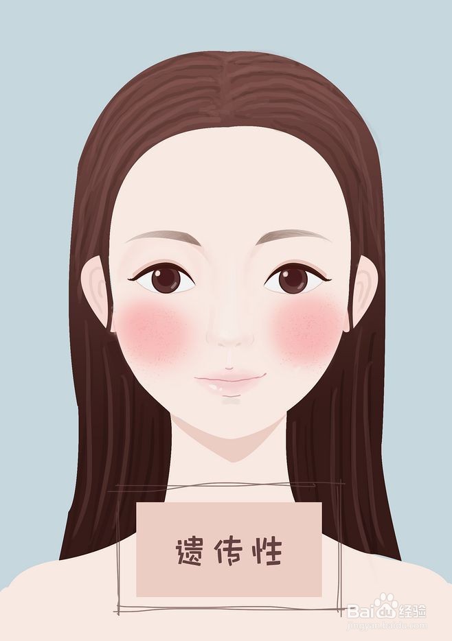 如何治疗遗传性红血丝