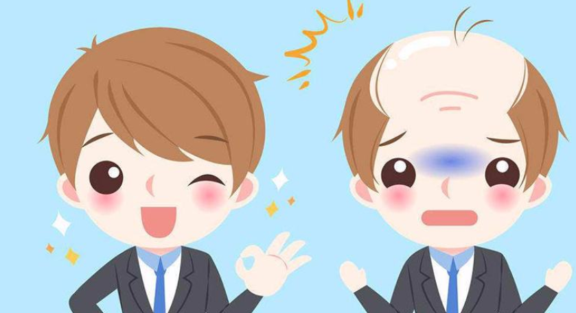 什么地方可以种植毛发