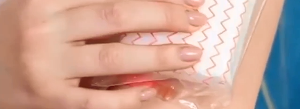 如何消除身上的淤青