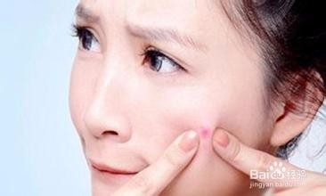 硫磺皂的正确使用方法