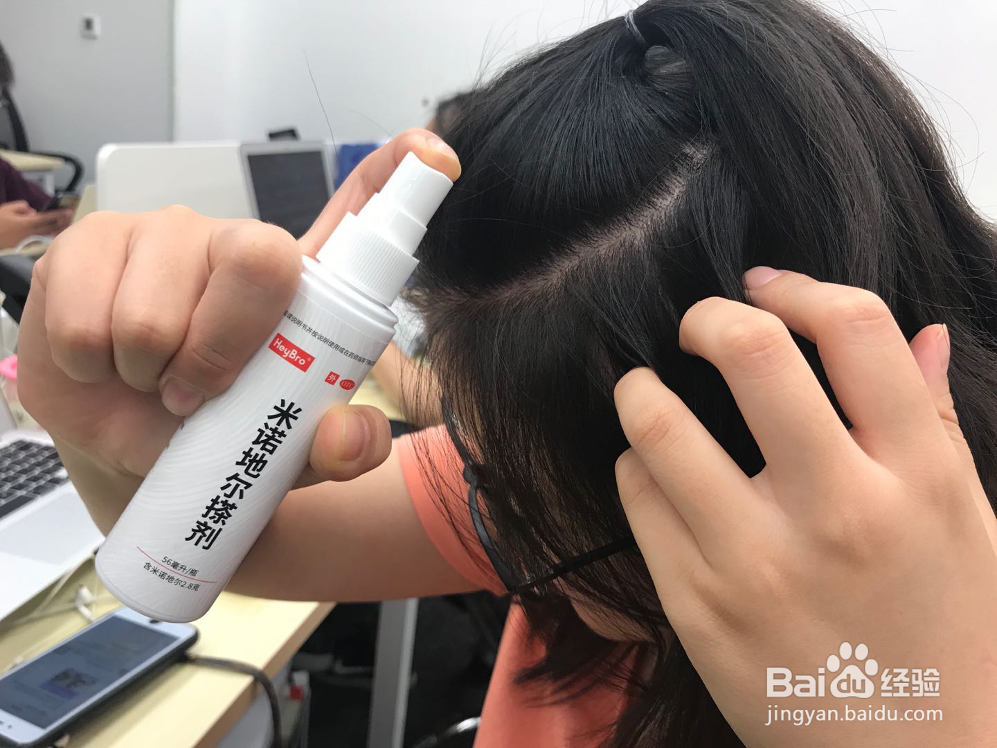 女生如何使用米诺地尔防脱生发?