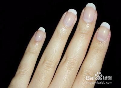 手指甲有点泛白是什么原因