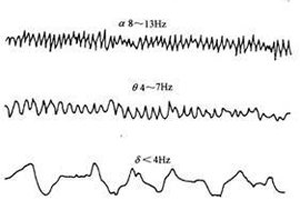 癫痫病患者复诊要做哪些准备