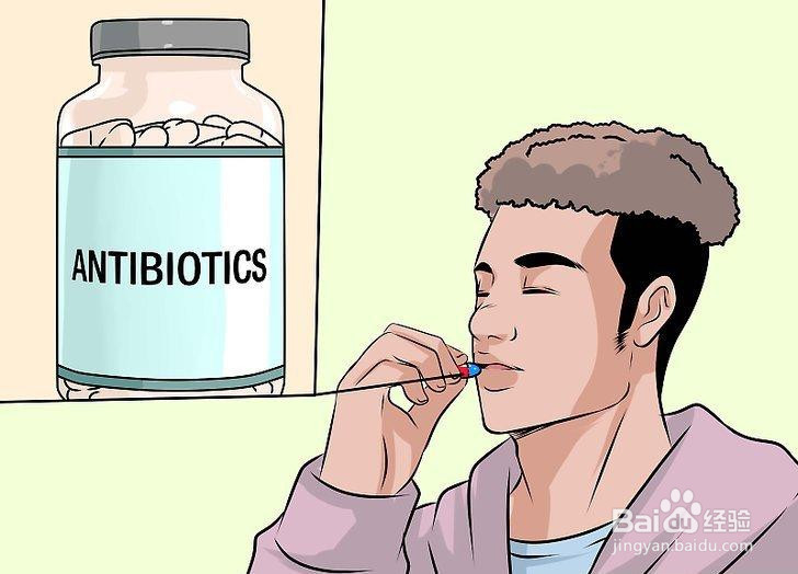 如何祛除扁桃体肿痛医疗方法