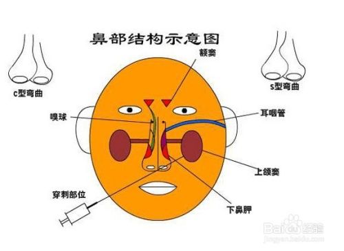 鼻前庭炎的预防方法 百度经验