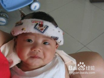 宝宝流鼻涕要不要吃药治疗呢?