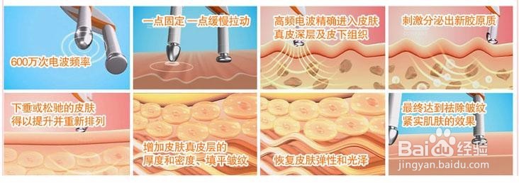 电波拉皮影响哺乳吗？