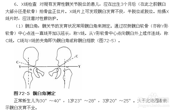 怎么在X线平片上确诊先髋