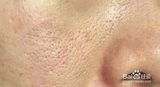 两位素：你的脸上堆积“垃圾”了吗？