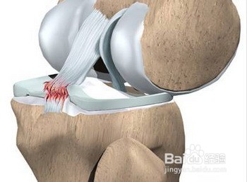 膝盖疼是怎么回事分情况护理膝关节