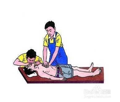 教您夏季如何急救防猝死