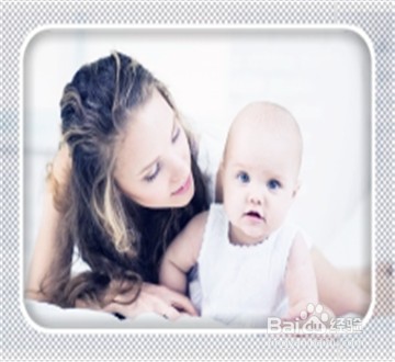 备孕期,需要做妇科B超吗?