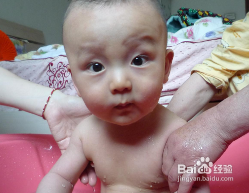 宝宝头上起皮怎么办