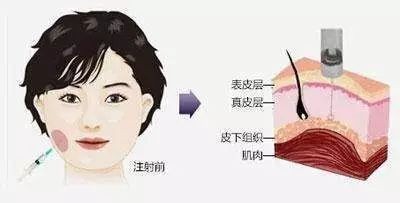 瘦脸常识（小知识）2