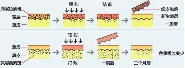 祛斑的方法有哪些